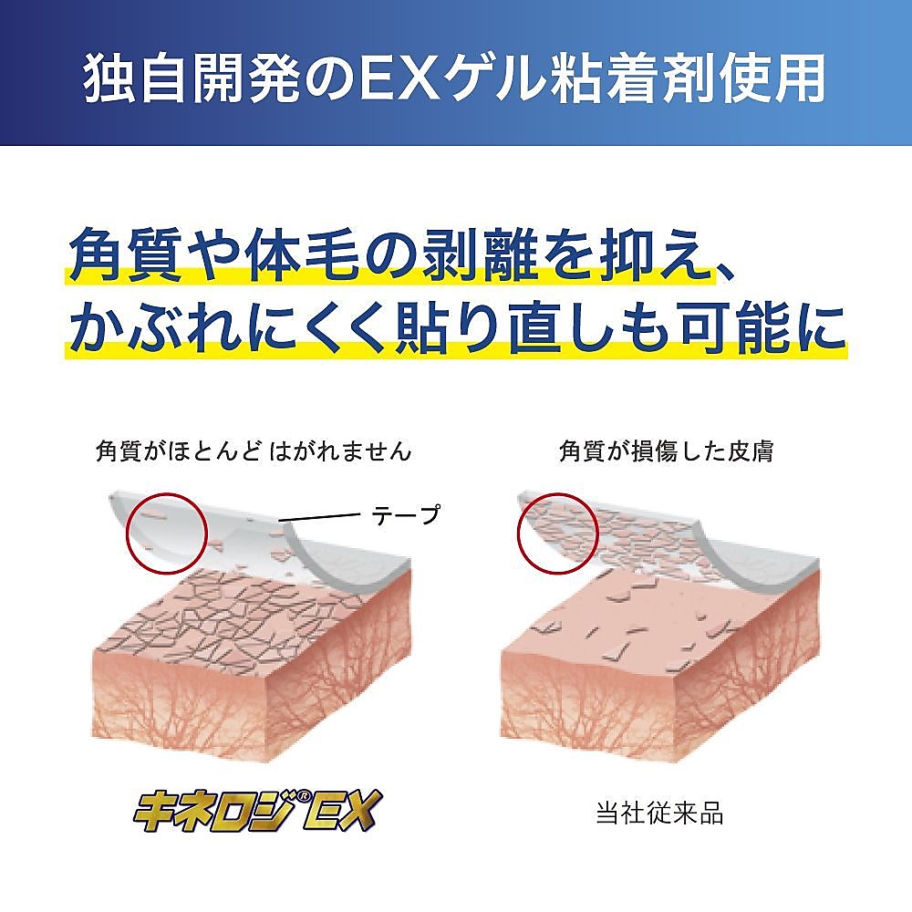 キネロジEXブリスターP25MM*4M(2マキ